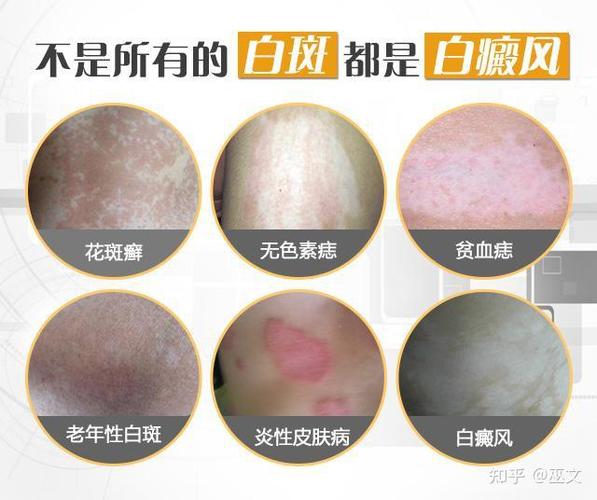 ���ݰ���Ƥ������ �������ư������