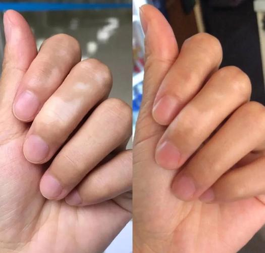 ʲôԭ���°��� ����ר�ΰ����ҽԺ����Щ