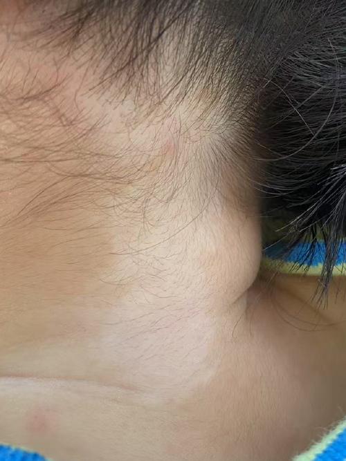 非处方青春 非处方青春剧情介绍 非处方青春 非处方青春剧情介绍