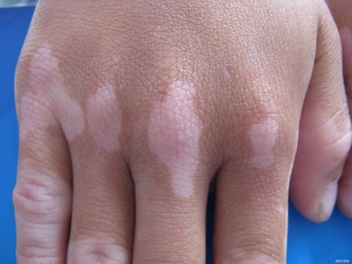 �γɰ���ļ�������