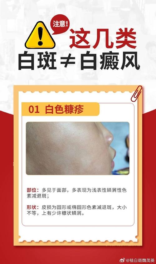 �ɶ����ưװߺ�ҽԺ������Ϊ��Щ�Ÿ�����