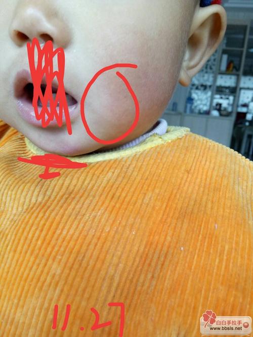 ��ͯ�������ƵĽ���