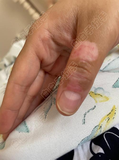 �κð�����Ҫ���ʱ��