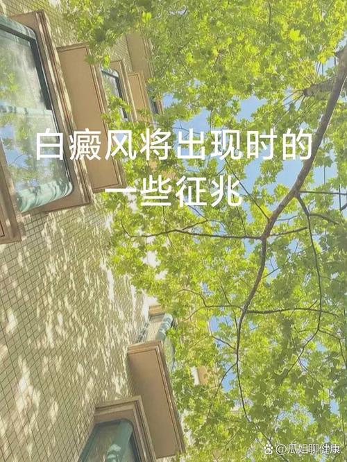 夏天白癜风怎么养护(夏天是白癜风高发期吗) 夏天白癜风怎么养护(夏天是白癜风高发期吗)
