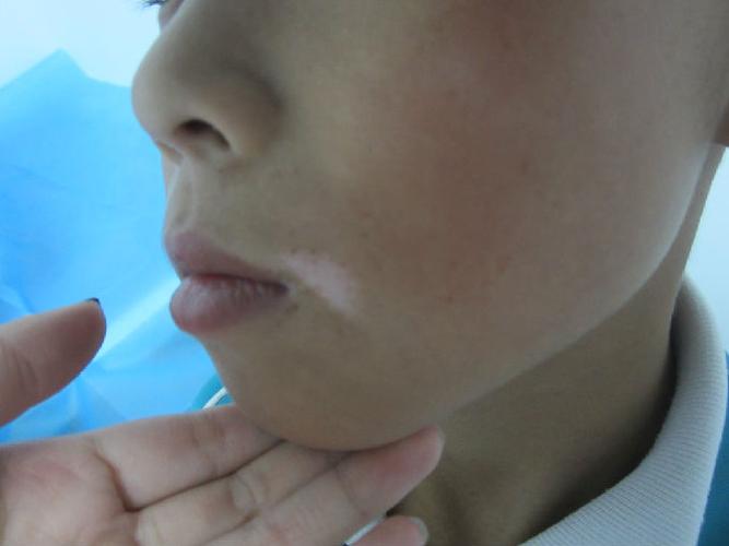 ���粻�ܳ�ʲô ����ȥ�������ư����