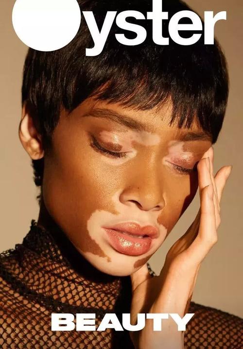 ���ʴ����ҽԺ �����к�֢״