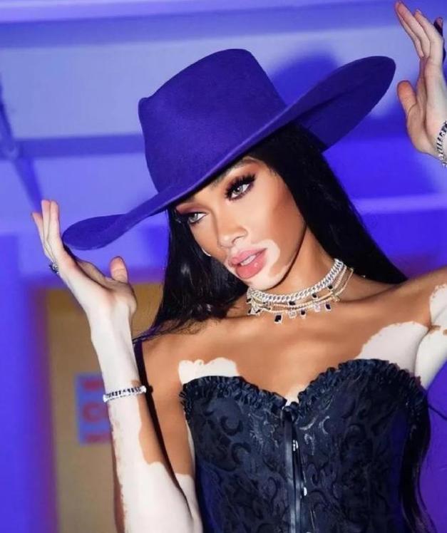 大理白癜风医院哪家好 大理白癜风医院哪家好