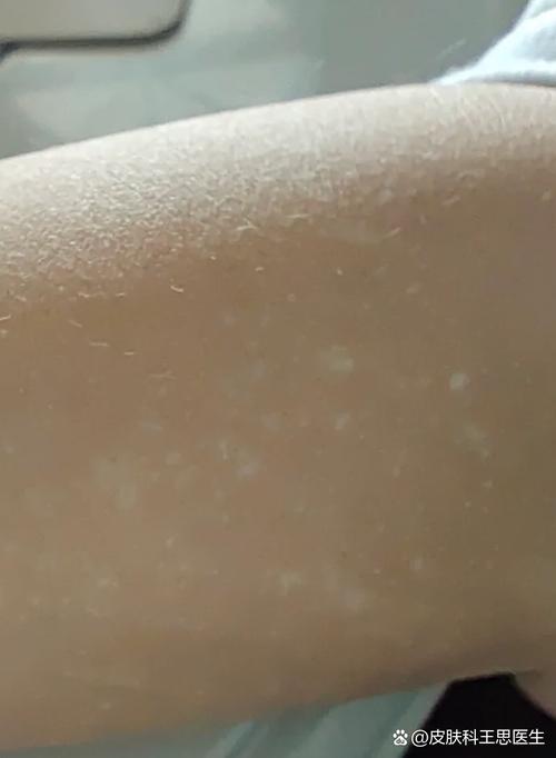 ��չ�ڰ���Ӧ������� ����ˮ���ư���������ҽԺ