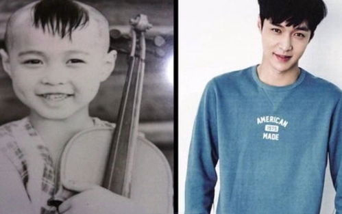 阶段性白癜风的原因 阶段性白癜风好治愈吗 阶段性白癜风的原因 阶段性白癜风好治愈吗