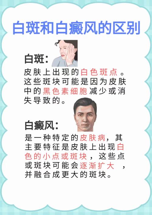 得白癜风女孩怎么安慰 得白癜风女孩怎么安慰