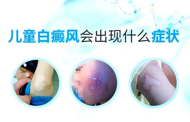 ʲô������°�����������