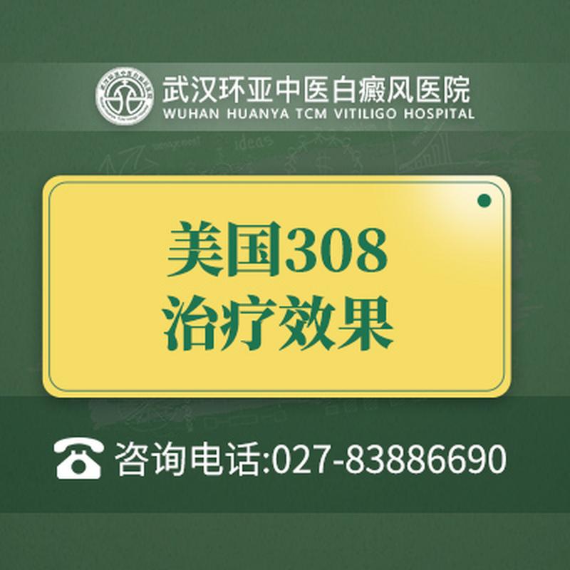 ��Ա�ű��ĸ�������