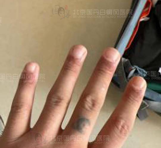 ����Ԥ����ͯ���� �ൺ���ư���õ�ר��ҽԺ