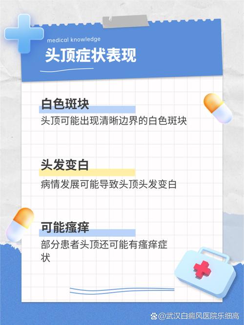 中山治白癜风的专业医院 影响白癜风的治果的因素有哪些 中山治白癜风的专业医院 影响白癜风的治果的因素有哪些