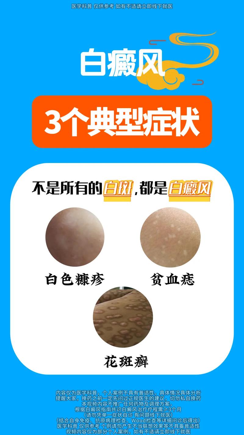 Ϋ��ר�ΰ���ҽԺ���ļ� ���ʶ�����֢״