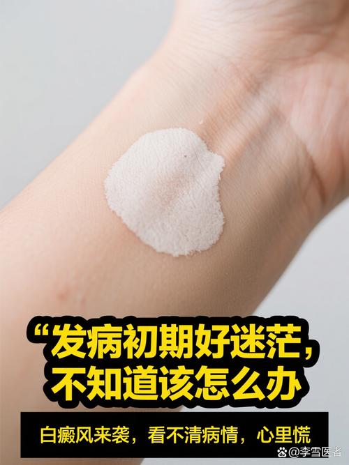 ��ɳ������ʲô����