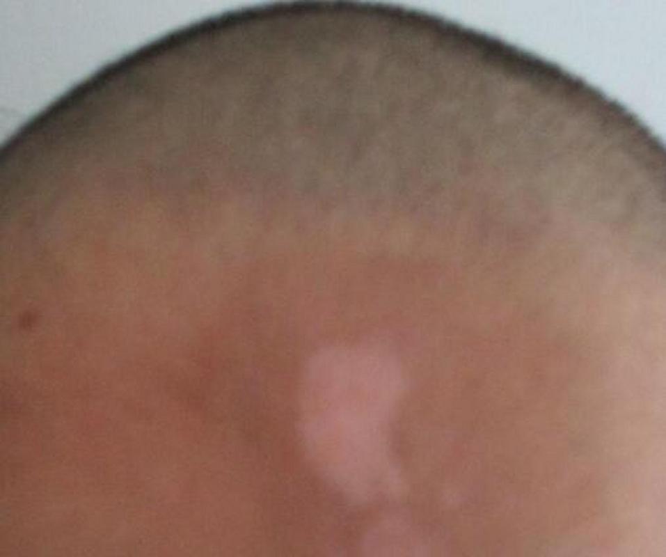 ȫ�����������ר��