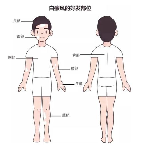 ���ݰװ߿������ ���ϰ����Ҫ��ô��������