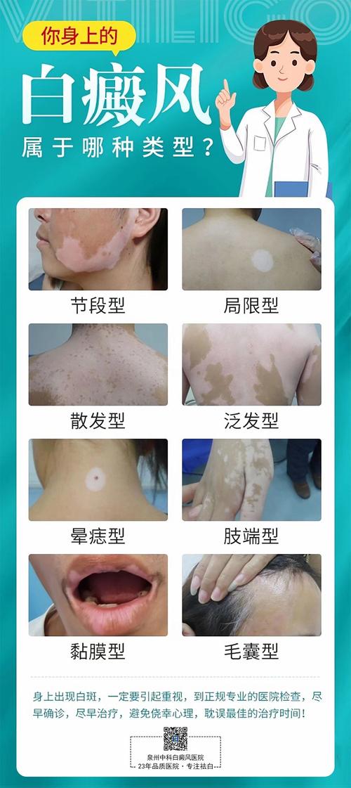 ƫ�����ư����κ���