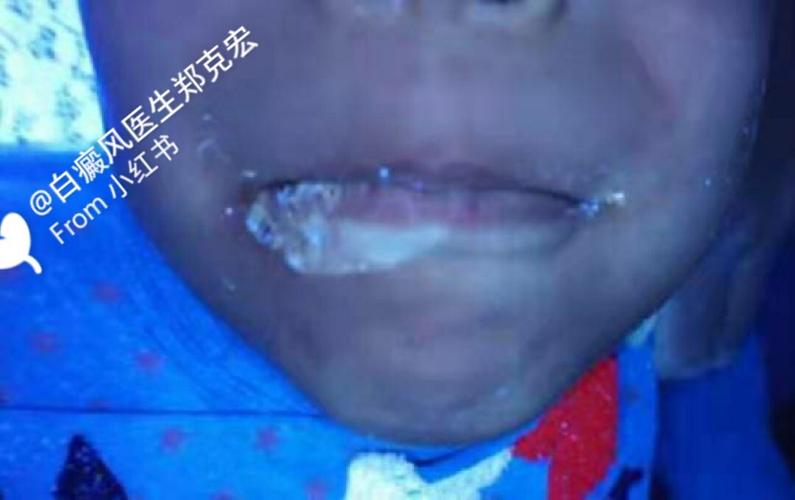 ��ɽ����ҽԺ����Щ