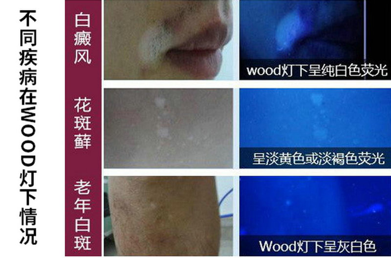 ���������ҩ220�� ������Ҫ��ҩ