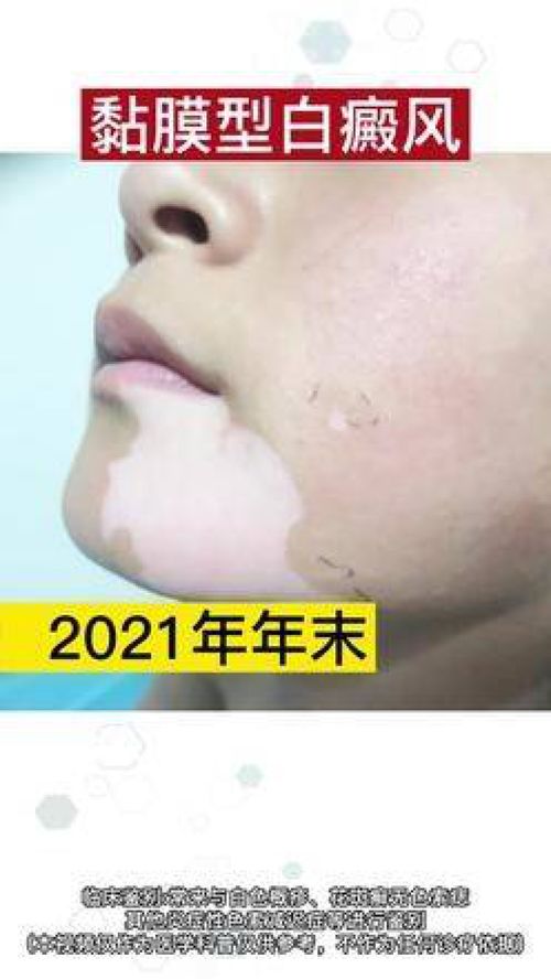 �������������ļҺ�