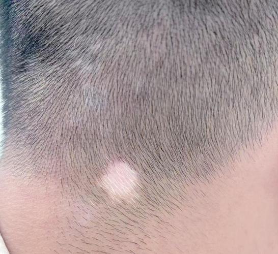 ����רҵ���ư�������ĸ�ҽԺ����ʪ