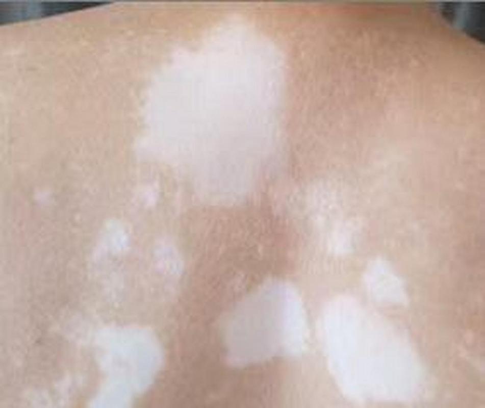 �����ΰ���ĵ�ҽԺ ������粡����ʲô