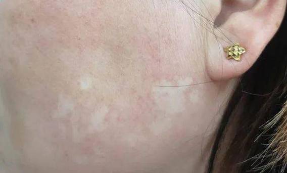 ������μ�ǿ�������󹮹����� ��ʲ�ļ�ҽԺ�ΰ�������