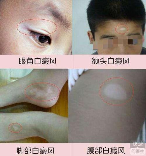 ���󼤹����縴��