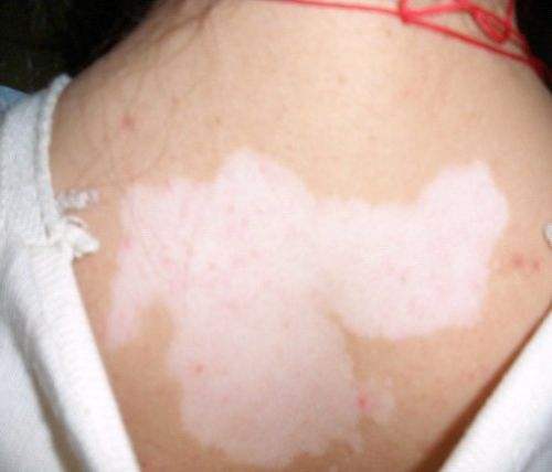 �Ϸʰ���ҽԺ��רҵ