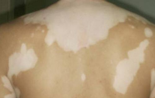 ֣���ļ�ҽԺ���ư���� �����ϰ�����ô�β�����