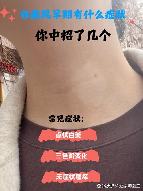 ���������۾�������