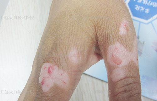 Ϊʲô�������������� ��������ҽԺ���ư����