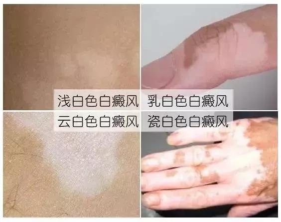 ��ɽ�ΰ����ҽԺ����� ���˰�����ô����