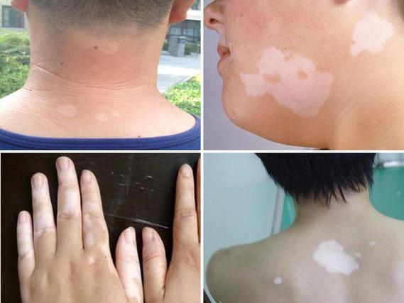 ��۸��ΰ�����ҩ�������ʲô