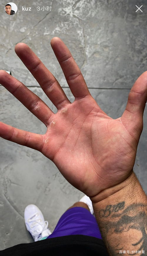 白癜风常识判断怀孕书籍 白癜风常识判断怀孕书籍