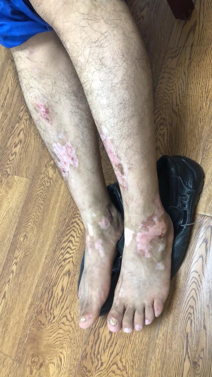 ���˰�����װ���ɢ