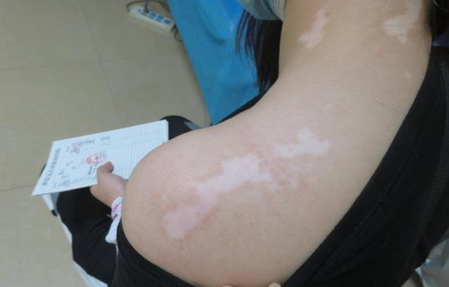 ��ɽ���ư���ȥ����� ����Ƥ������ô��