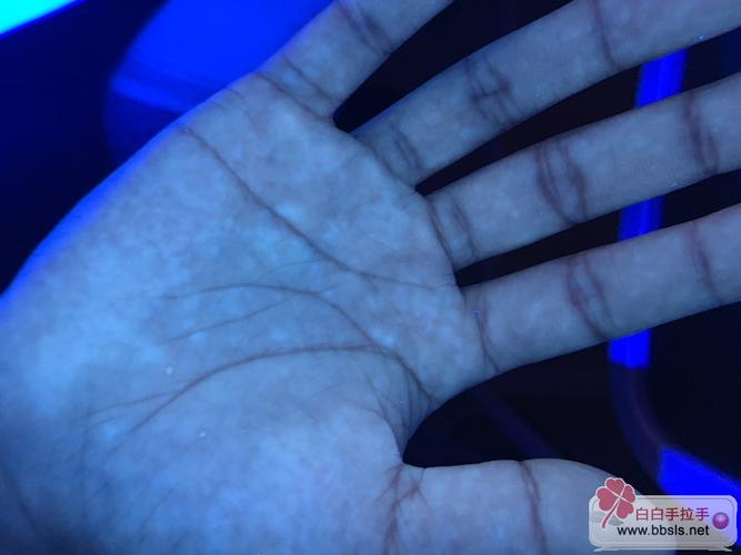 ������ٴ�������ʲô Ϋ���ΰ���õ�ר��ҽԺ