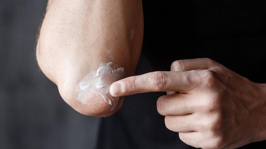 6岁小孩得白癜风 6岁小孩得白癜风怎么办 6岁小孩得白癜风 6岁小孩得白癜风怎么办