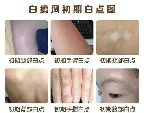 ҽ�ΰ���ҩ������ ұ�ư����ҩ