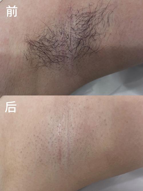 �ൺ������Ƥ��������