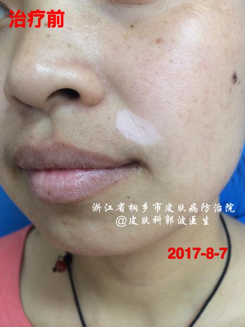 �ɶ����Դ����ϵİװ��ǰ�����