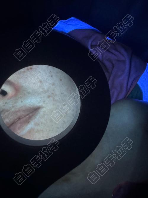 �ϳ�����Щר�ΰ����ҽԺ ����ע����������Щ